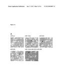 miRNA Compounds for Treatment of Prostate CarcinomaAANM Boll; KerstinAACI LeipzigAACO DEAAGP Boll; Kerstin Leipzig DEAANM Horn; FriedemannAACI LeipzigAACO DEAAGP Horn; Friedemann Leipzig DEAANM Hackermuller; JorgAACI LeipzigAACO DEAAGP Hackermuller; Jorg Leipzig DE diagram and image