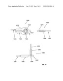 Devices and methods for ECG guided vascular access diagram and image