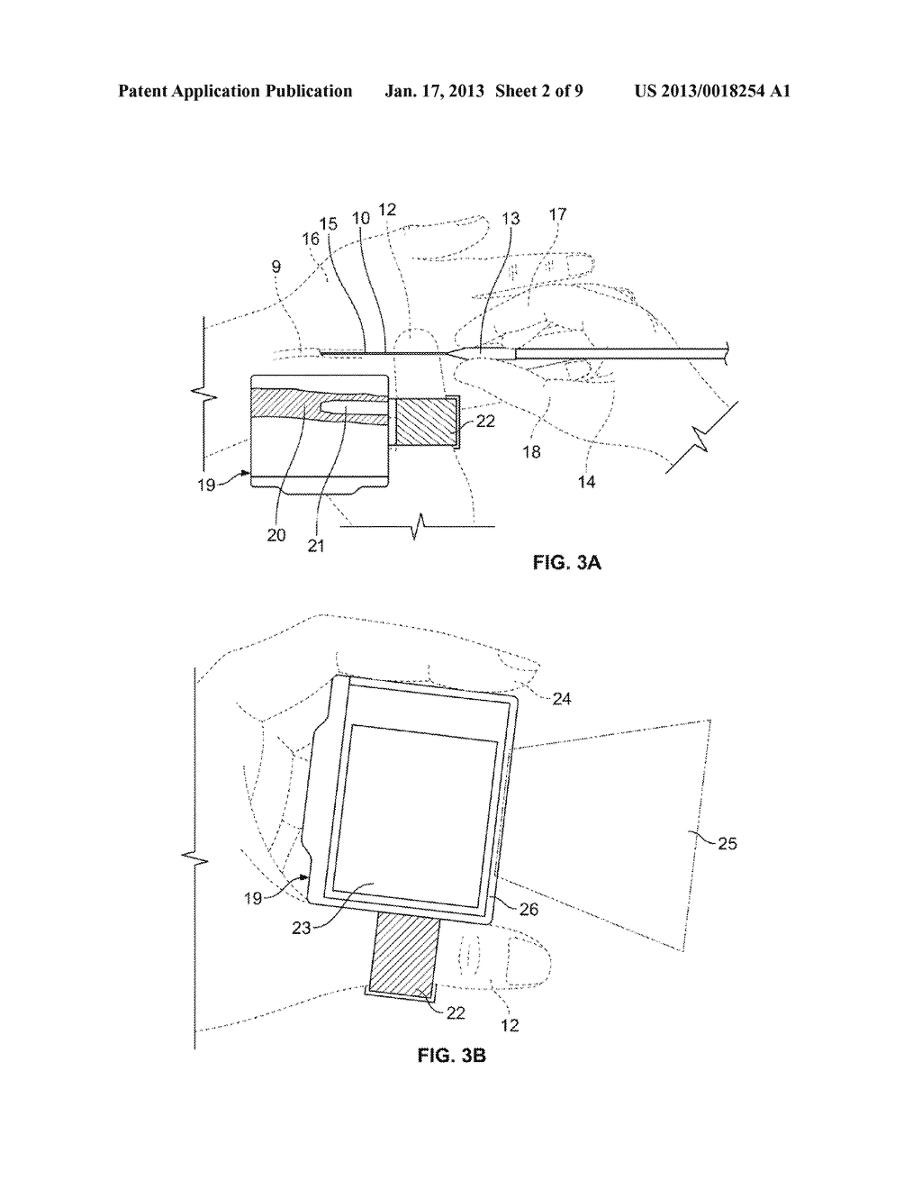 APPARATUS AND METHODS FOR IMAGING BLOOD VESSELS - diagram, schematic, and image 03