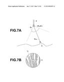 ENDOSCOPE OBSERVATION ASSISTANCE SYSTEM, METHOD, APPARATUS AND PROGRAMAANM Kitamura; YoshiroAACI Minato-kuAACO JPAAGP Kitamura; Yoshiro Minato-ku JPAANM Nakamura; KeigoAACI Minato-kuAACO JPAAGP Nakamura; Keigo Minato-ku JP diagram and image