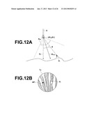 ENDOSCOPE OBSERVATION ASSISTANCE SYSTEM, METHOD, APPARATUS AND PROGRAMAANM Kitamura; YoshiroAACI Minato-kuAACO JPAAGP Kitamura; Yoshiro Minato-ku JPAANM Nakamura; KeigoAACI Minato-kuAACO JPAAGP Nakamura; Keigo Minato-ku JP diagram and image