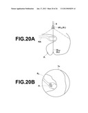 ENDOSCOPE OBSERVATION ASSISTANCE SYSTEM, METHOD, APPARATUS AND PROGRAMAANM Kitamura; YoshiroAACI Minato-kuAACO JPAAGP Kitamura; Yoshiro Minato-ku JPAANM Nakamura; KeigoAACI Minato-kuAACO JPAAGP Nakamura; Keigo Minato-ku JP diagram and image