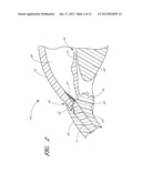 OCULAR IMPLANT WITH ANCHORING MECHANISM AND MULTIPLE OUTLETS diagram and image