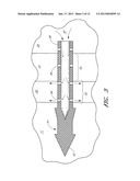 OCULAR IMPLANT WITH ANCHORING MECHANISM AND MULTIPLE OUTLETS diagram and image