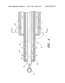 OCULAR IMPLANT WITH ANCHORING MECHANISM AND MULTIPLE OUTLETS diagram and image