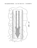 OCULAR IMPLANT WITH ANCHORING MECHANISM AND MULTIPLE OUTLETS diagram and image