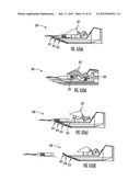 Insertion Device for an Insertion Set and Method of Using the Same diagram and image