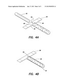 MEDICAL DEVICES AND METHODS COMPRISING AN ADHESIVE MATERIALAANM McKay; William F.AACI MemphisAAST TNAACO USAAGP McKay; William F. Memphis TN US diagram and image