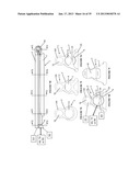 VACUUM COAGULATION PROBES diagram and image