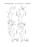 VACUUM COAGULATION PROBES diagram and image