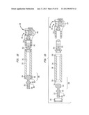 EXTERNAL FIXATION SYSTEM diagram and image