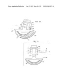 EXTERNAL FIXATION SYSTEM diagram and image