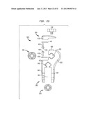 EXTERNAL FIXATION SYSTEM diagram and image