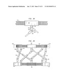 EXTERNAL FIXATION SYSTEM diagram and image