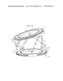 EXTERNAL FIXATION SYSTEM diagram and image