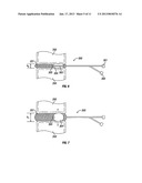 Devices and Methods For the Preparation of Intervertebral DiscsAANM Yoon; SamuelAACI WyndmoorAAST PAAACO USAAGP Yoon; Samuel Wyndmoor PA USAANM Suh; SeanAACI BensalemAAST PAAACO USAAGP Suh; Sean Bensalem PA USAANM Leonard; RobertAACI FurlongAAST PAAACO USAAGP Leonard; Robert Furlong PA US diagram and image