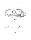 ROTATIONAL ATHERECTOMY DEVICE WITH ELECTRIC MOTOR diagram and image