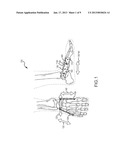 OSTEOTOMY AND ARTHRODESIS TREATMENT SYSTEMAANM Subik; MichaelAACI Atlantic HighlandsAAST NJAACO USAAGP Subik; Michael Atlantic Highlands NJ US diagram and image