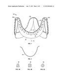 TECHNIQUES FOR ATTACHING FLEXIBLE LEAFLETS OF PROSTHETIC HEART VALVES TO     SUPPORTING STRUCTURESAANM Li; XueMeiAACI ShoreviewAAST MNAACO USAAGP Li; XueMei Shoreview MN USAANM Woo; Yi-RenAACI WoodburyAAST MNAACO USAAGP Woo; Yi-Ren Woodbury MN US diagram and image