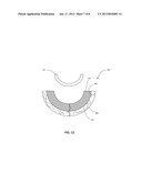 RAPID MANUFACTURING OF POROUS METAL PROSTHESES diagram and image