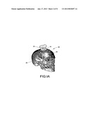 METHODS AND SYSTEMS FOR PRODUCING AN IMPLANT diagram and image