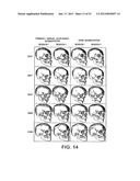 METHODS AND SYSTEMS FOR PRODUCING AN IMPLANT diagram and image