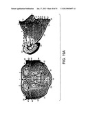 METHODS AND SYSTEMS FOR PRODUCING AN IMPLANT diagram and image