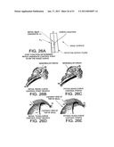 METHODS AND SYSTEMS FOR PRODUCING AN IMPLANT diagram and image