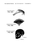 METHODS AND SYSTEMS FOR PRODUCING AN IMPLANT diagram and image