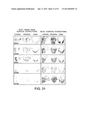 METHODS AND SYSTEMS FOR PRODUCING AN IMPLANT diagram and image