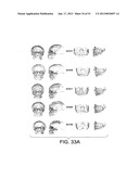 METHODS AND SYSTEMS FOR PRODUCING AN IMPLANT diagram and image