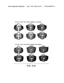 METHODS AND SYSTEMS FOR PRODUCING AN IMPLANT diagram and image