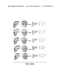 METHODS AND SYSTEMS FOR PRODUCING AN IMPLANT diagram and image