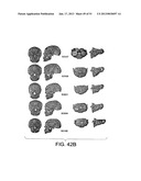 METHODS AND SYSTEMS FOR PRODUCING AN IMPLANT diagram and image