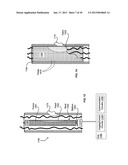 Specialty stents with flow control features or the likeAANM Jung; Edward K.Y.AACI BellevueAAST WAAACO USAAGP Jung; Edward K.Y. Bellevue WA USAANM Langer; RobertAACI NewtonAAST MAAACO USAAGP Langer; Robert Newton MA USAANM Leuthardt; Eric C.AACI St. LouisAAST MOAACO USAAGP Leuthardt; Eric C. St. Louis MO USAANM Levien; Royce A.AACI LexingtonAAST MAAACO USAAGP Levien; Royce A. Lexington MA USAANM Lord; Robert W.AACI SeattleAAST WAAACO USAAGP Lord; Robert W. Seattle WA USAANM Malamud; Mark A.AACI SeattleAAST WAAACO USAAGP Malamud; Mark A. Seattle WA USAANM Rinaldo, JR.; John D.AACI BellevueAAST WAAACO USAAGP Rinaldo, JR.; John D. Bellevue WA USAANM Tegreene; Clarence T.AACI BellevueAAST WAAACO USAAGP Tegreene; Clarence T. Bellevue WA USAANM Wood, JR.; Lowell L.AACI LivermoteAAST CAAACO USAAGP Wood, JR.; Lowell L. Livermote CA US diagram and image