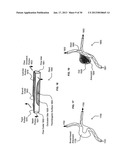 Specialty stents with flow control features or the likeAANM Jung; Edward K.Y.AACI BellevueAAST WAAACO USAAGP Jung; Edward K.Y. Bellevue WA USAANM Langer; RobertAACI NewtonAAST MAAACO USAAGP Langer; Robert Newton MA USAANM Leuthardt; Eric C.AACI St. LouisAAST MOAACO USAAGP Leuthardt; Eric C. St. Louis MO USAANM Levien; Royce A.AACI LexingtonAAST MAAACO USAAGP Levien; Royce A. Lexington MA USAANM Lord; Robert W.AACI SeattleAAST WAAACO USAAGP Lord; Robert W. Seattle WA USAANM Malamud; Mark A.AACI SeattleAAST WAAACO USAAGP Malamud; Mark A. Seattle WA USAANM Rinaldo, JR.; John D.AACI BellevueAAST WAAACO USAAGP Rinaldo, JR.; John D. Bellevue WA USAANM Tegreene; Clarence T.AACI BellevueAAST WAAACO USAAGP Tegreene; Clarence T. Bellevue WA USAANM Wood, JR.; Lowell L.AACI LivermoteAAST CAAACO USAAGP Wood, JR.; Lowell L. Livermote CA US diagram and image