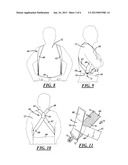 UNDERGARMENT SUSPENDERS ATTACHED TO HIPS AT TWO LOCATIONS diagram and image