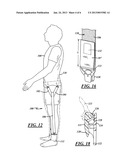 UNDERGARMENT SUSPENDERS ATTACHED TO HIPS AT TWO LOCATIONS diagram and image