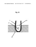 Oral Cleaning Implement Having A Plastic Staple Comprising A Cavity diagram and image