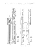 SURGICAL INSTRUMENT diagram and image