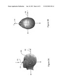 SYSTEM AND METHOD OF DETECTING SLEEP DISORDERS diagram and image