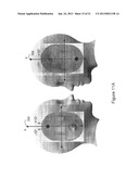 SYSTEM AND METHOD OF DETECTING SLEEP DISORDERS diagram and image