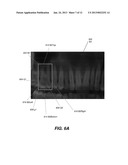 PANORAMIC IMAGE GENERATION FROM CBCT DENTAL IMAGES diagram and image