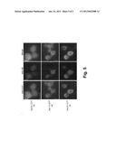 YEAST CELLS EXPRESSING AMYLOID BETA AND USES THEREFOR diagram and image