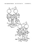 TENSIONING ARRANGEMENT HAVING A SWINGING ARM diagram and image