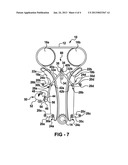 TENSIONING ARRANGEMENT HAVING A SWINGING ARM diagram and image