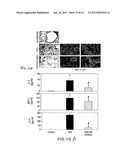 Methods Involving Aldose Reductase Inhibitors diagram and image