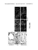 Methods Involving Aldose Reductase Inhibitors diagram and image