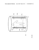 TRACKING OF TUMOR LOCATION FOR TARGETED RADIATION TREATMENT diagram and image