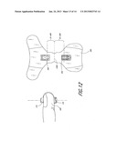 OPTICAL SENSOR INCLUDING DISPOSABLE AND REUSABLE ELEMENTS diagram and image